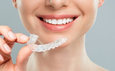 Allineatori invisibili: come funzionano e quali problemi risolvono