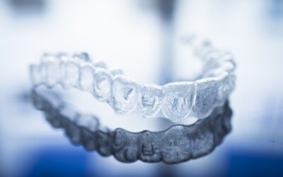 Cosa sono gli allineatori dentali e quali problemi possono risolvere?